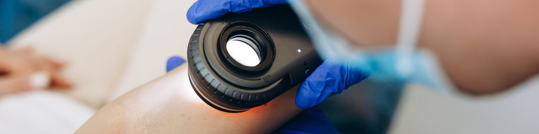 Mole Removal in Nottingham