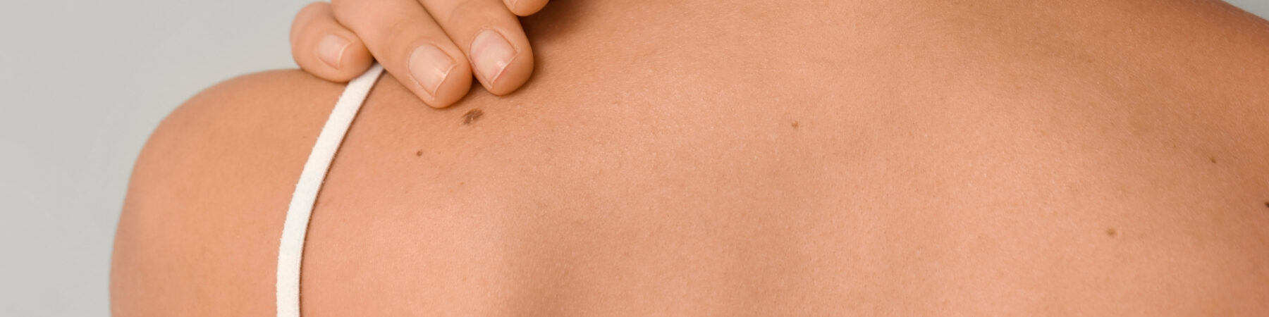 Mole Removal Nottingham