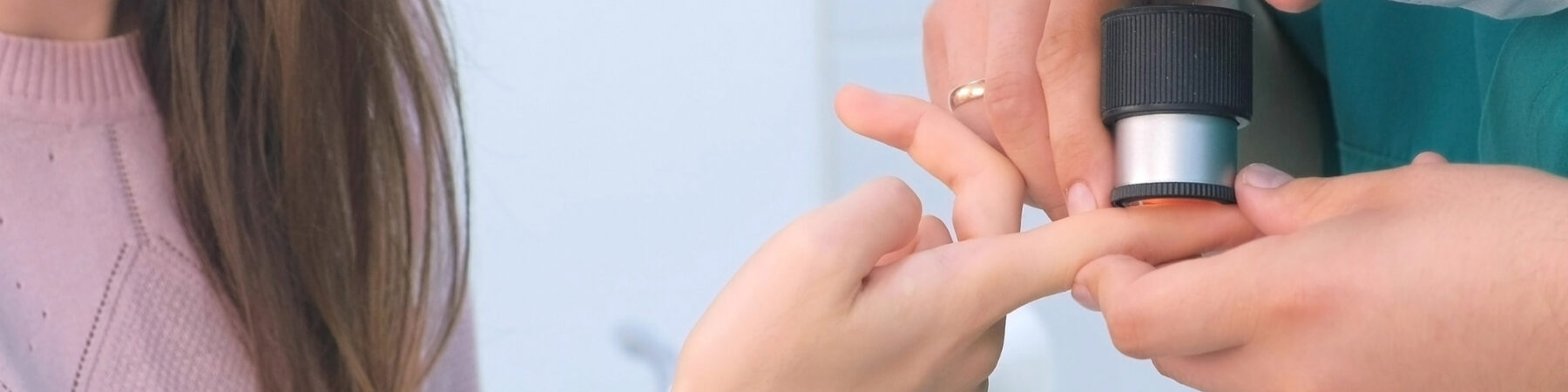 Wart Removal in Nottingham