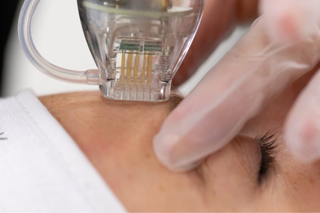 3D Dermaforce Nottingham